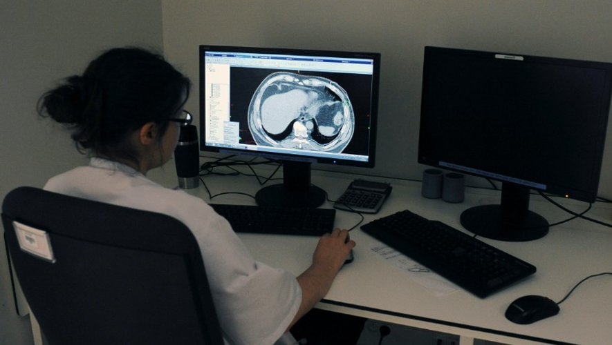 Un médecin regarde une radio des poumons à l'Institut universitaire du cancer, à Toulouse, le 4 juin 2015