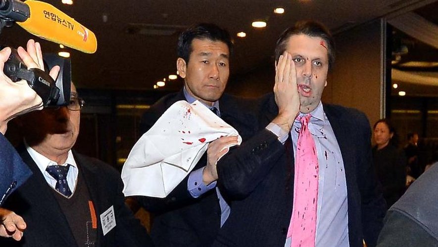 Photo fournie par le journal sud coréen "Asia Economy Daily" montrant l'ambassadeur américain en Corée du Sud Mark Lippert (C) quittant l'Institut culturel Sejong à Séoul après avoir été attaqué par un nationaliste coréen, le 5 mars 2015