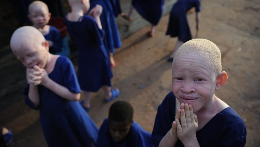 Des enfants albinos sont recueillis dans une école en Tanzanie, le 25 janvier 2009