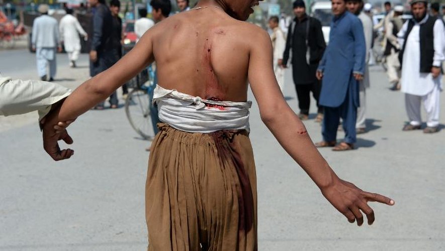 Un Afghan blessé après un attentat suicide qui s'est produit à Jalalabad (est), le 10 avril 2015