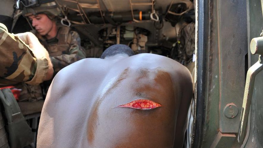 Un homme blessé à coup de machette soigné par des soldats français après une attaque des milices chrétiennes anti-Balaka, le 22 janvier 2014 dans le quartier PK 13 à majorité musulmane de Bangui