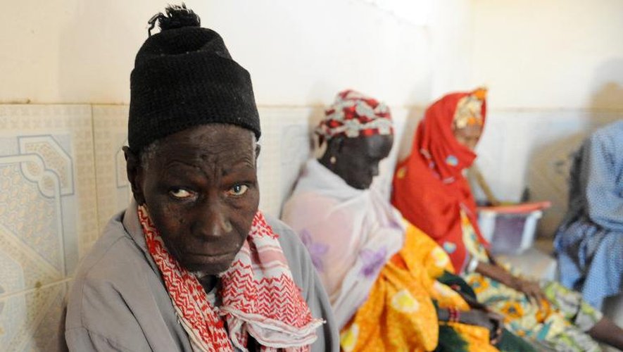 Une personne âgée guérie de la lèpre vivant encore dans le village de "reclassement social" de Mballing au Sénégal où ont été regroupés des lépreux dans les années 50