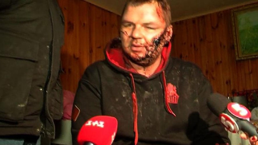 Capture d'écran de la TV ukrainienne Channel 5 de Dmytro Boulatov, un militant ukrainien enlevé et torturé, face aux journalistes le 31 janvier 2014 à Kiev