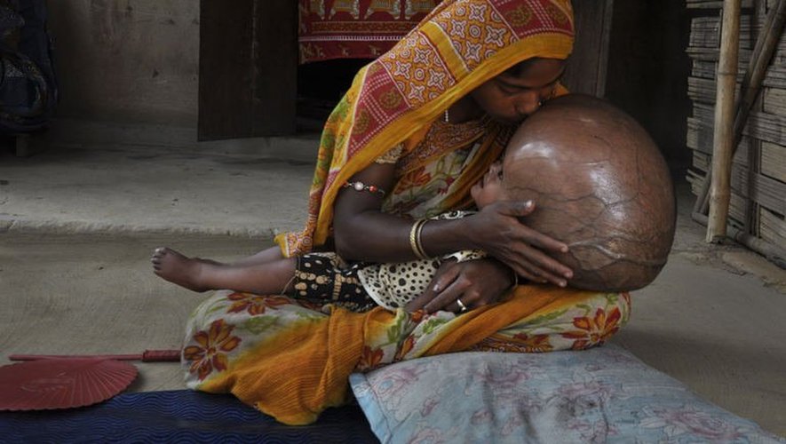 La jeune Roona Begum et sa mère, le 1er avril 2013 dans le village de Jirania, en Inde