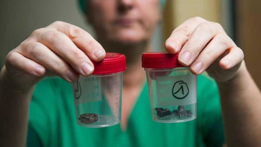 Une infirmière de l'hôpital de Louvain montre des fragments de bombes retrouvés sur les corps des victimes le 24 mars 2016