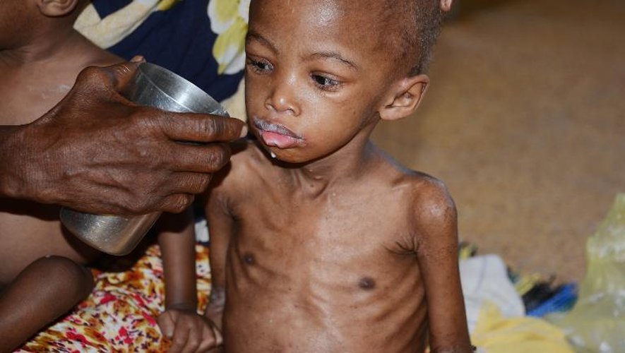 Un enfant souffrant de malnutrition reçoit des soins le 20 mai 2014 dans un hôpital de Mogadiscio, en Somalie