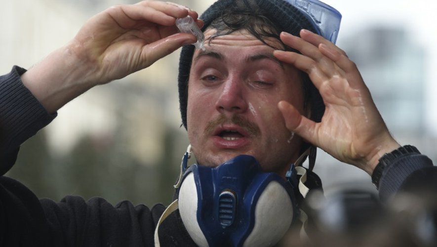 Un manifestant nettoie ses yeux au sérum physiologique après avoir reçu des gaz lacrymogènes, à Rennes, le 9 avril 2016 lors de la manifestation contre la loi travail