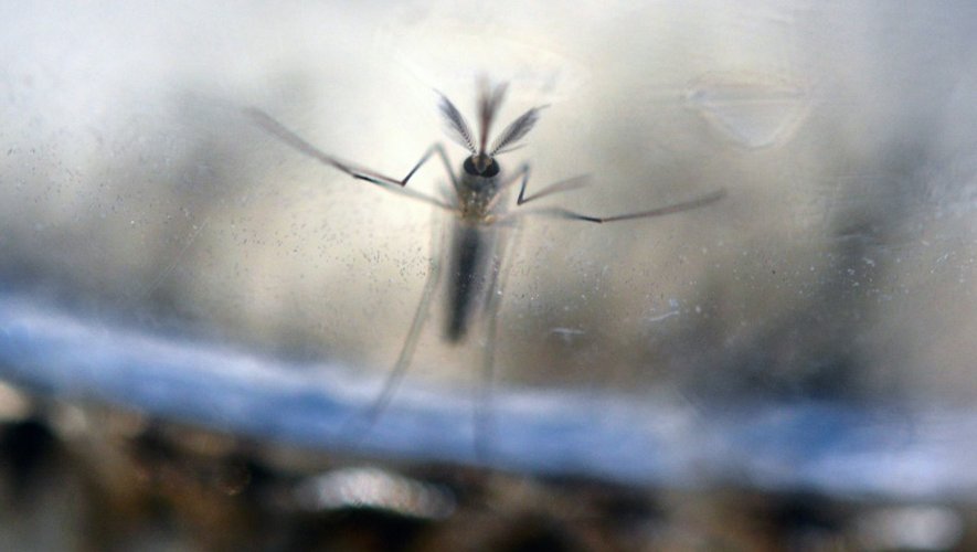 Des scientifiques américains confirment le lien entre Zika et microcéphalie du foetus