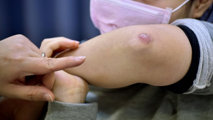 La mère d'une fillette montre le bras de sa fille blessée lors d'une classe le 11 novembre 2015 à Tokyo
