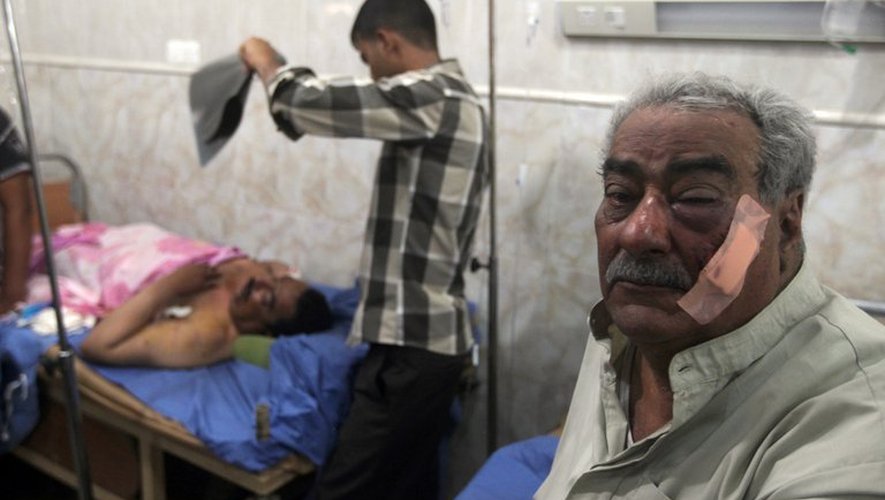 Des hommes blessés par une explosion à Aziziyah, le 16 juin 2013