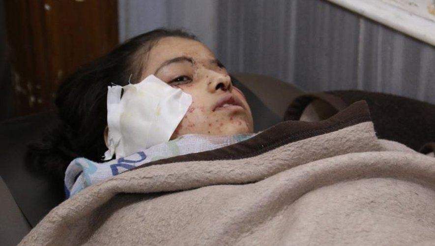 Une petite fille syrienne blessée dans un hôpital de fortune après un raid aérien de l'aviation syrienne qui a touché l'école Ain Jalout dans le quartier d'Ansari à Alep, le 30 avril 2014