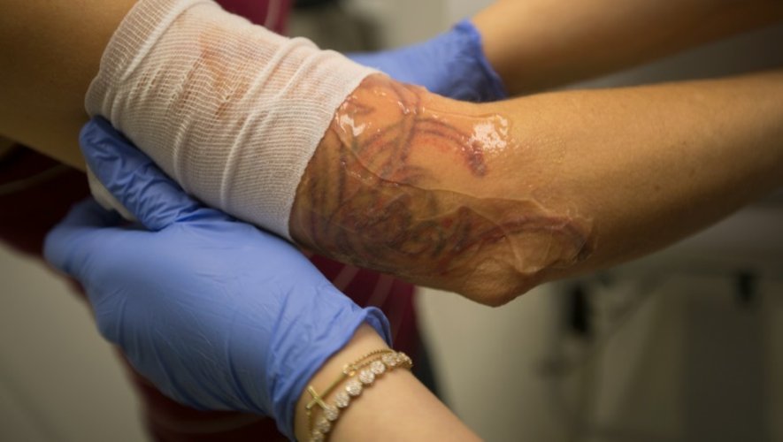Les études montrent que de plus en plus d'Américains se font tatouer (un adulte sur cinq selon l'une d'elles), mais qu'ils sont aussi de plus en plus nombreux à le regretter