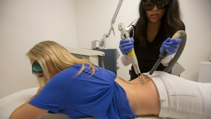 Une infirmière éclaircit au laser le tatouage d'une patiente dans une clinique de Beverly Hills, le 11 mai 2016