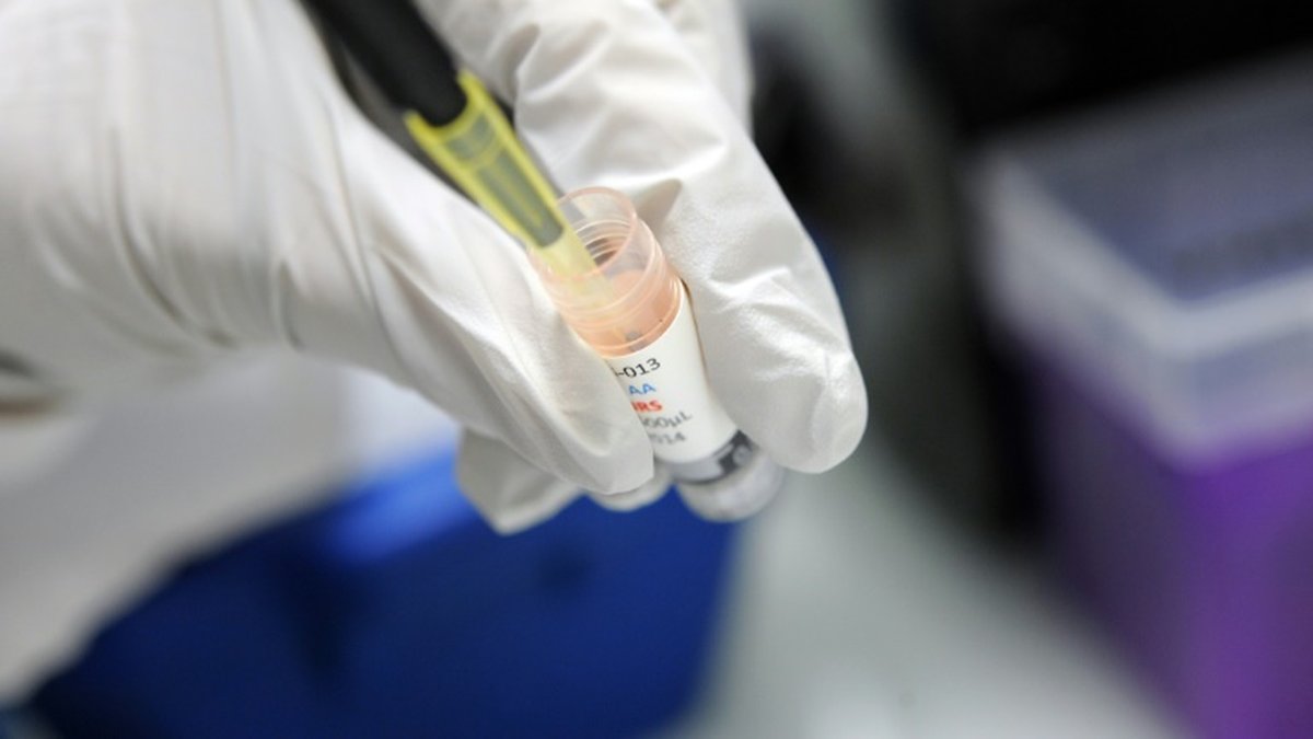 Un simple test sanguin plus efficace pour détecter des cancers et mieux ...