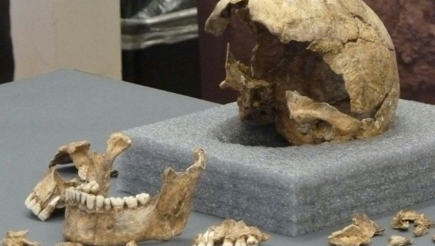 Un crâne d'un colon anglais ayant vécu à Jamestown au début du XVIIème siècle, exposé au Smithsonian Institute à Washington, le 28 juillet 2015