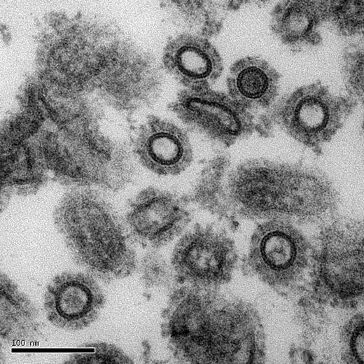 La grippe H1N1 est à l’origine de 280 000 décès détectés entre 2009 et 2010. © Inserm/Roingeard, Philippe/Goudeau, Alain