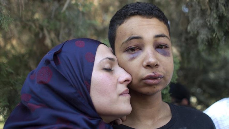 Le jeune Palestinien roué de coups par des gardes-frontières israéliens à Jérusalem-Est, et sa mère le 6 juillet 2014 à Jérusalem