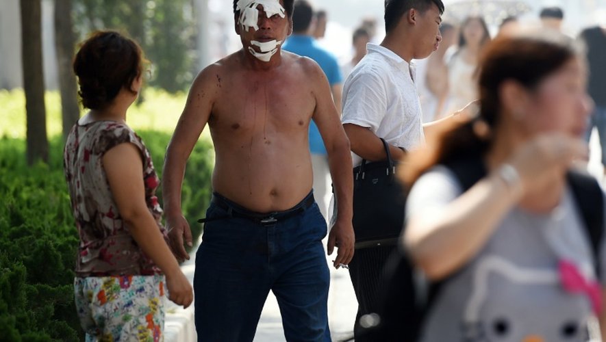 Un homme blessé par les explosions marche dans une rue de Tianjin, dans le nord-est de la Chine, après avoir reçu des soins, le 13 août 2015