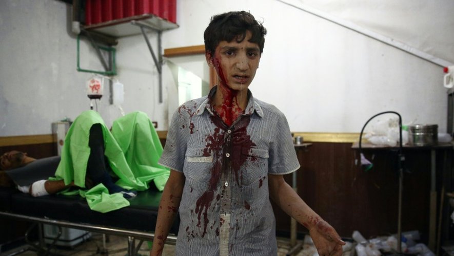 Un garçon syrien attend de recevoir des soins dans un hôpital de fortune installé à Douma, ville tenue par les rebelles à 13km de Damas, après des frappes aériennes du régime, le 16 août 2015