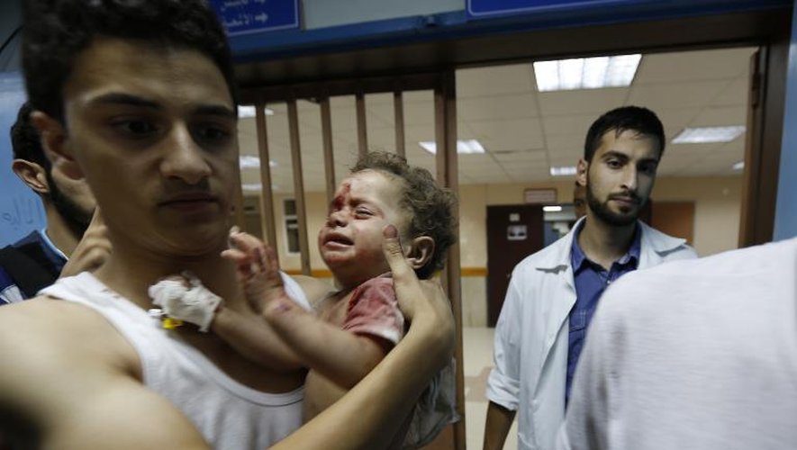 Un bébé soigné le 18 juillet 2014 à l'hôpital al-Shifa à Gaza