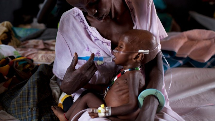 Un enfant souffrant de malnutrition sévère dans un camp de MSF à Minkamman au Soudan du Sud le 3 mars 2014