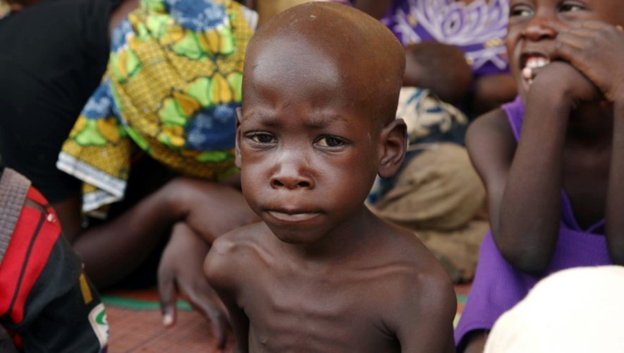 Des enfants souffrant de malnutrition le 5 mai 2015 à Yola au Nigeria