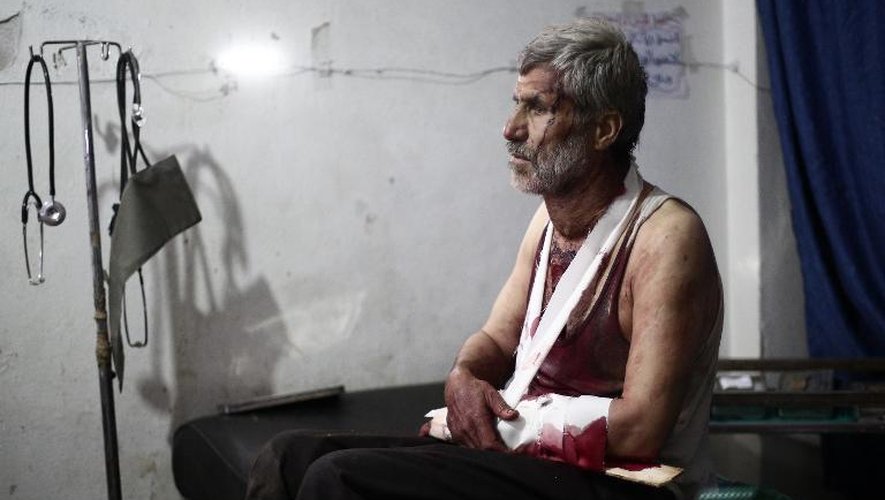 Un homme blessé à l'hôpital à Douma, au nord-est de Damas, le 24 août 2014