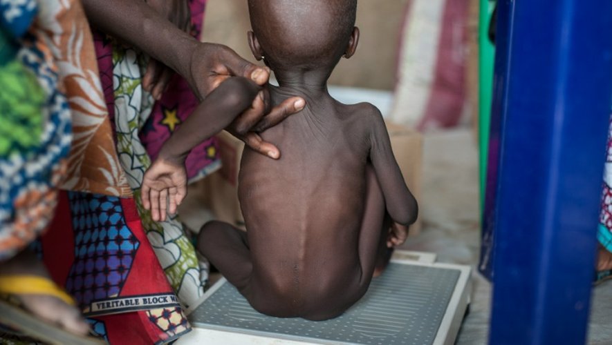 Une fillette souffrant de malnutrition le 30 juin 2016 à Maiduguri au Nigeria