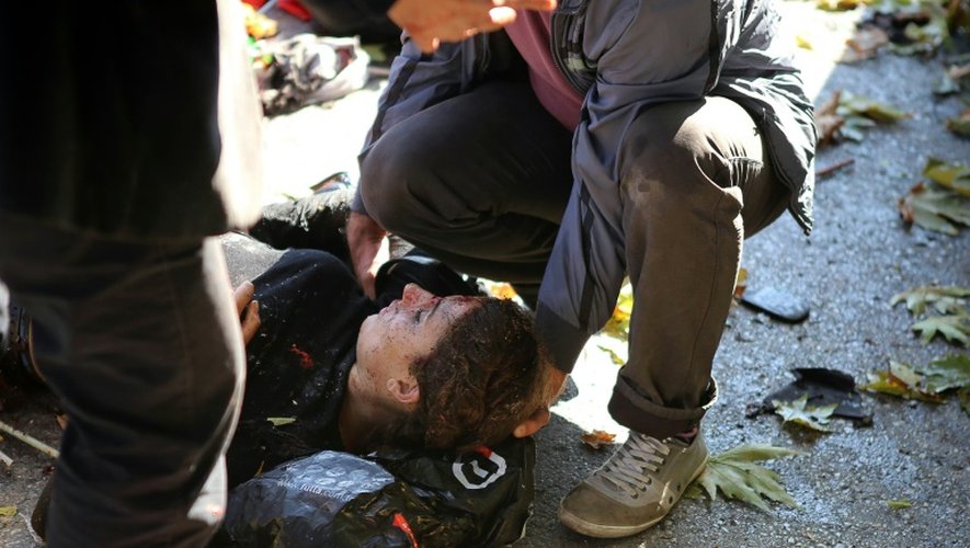 Une personne blessée dans la double explosion meurtrière le 10 octobre 2015 à Ankara