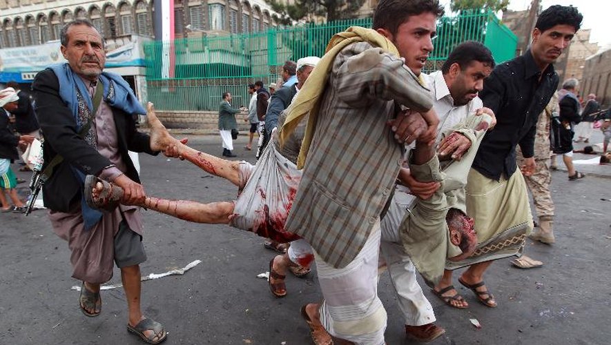Des habitants de Sanaa évacue un blessé lors d'un attentat suicide anti-chiite, le 9 octobre 2014 au Yémen
