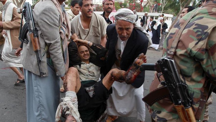 Un homme blessé lors de l'explosion d'une bombe dans la capitale yéménite Sanaa, est évacué des lieux, le 9 octobre 2014