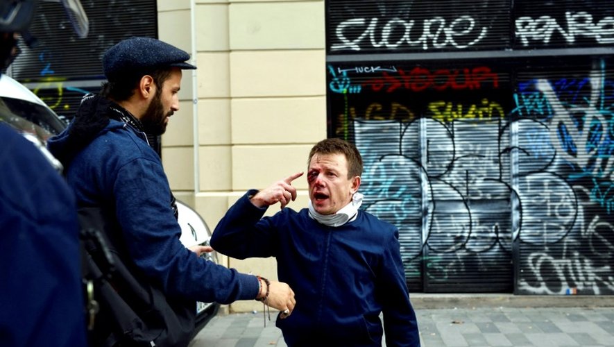 Laurent Theron montre la blessure qu'il a reçue lors de la manifestation contre la loi travail, à Paris le 15 septembre 2016