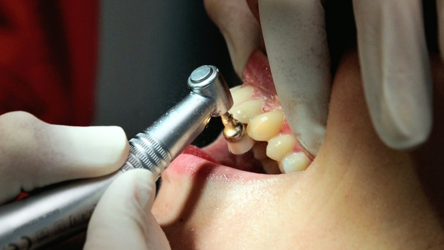 25% du coût des soins dentaires reste à la charge du patient en France contre 10% en Allemagne