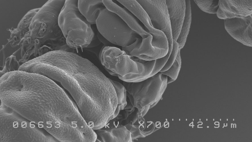 En séquençant l'ADN de tardigrade, les chercheurs ont identifié une protéine qui protège cet ADN lorsqu'il est irradié