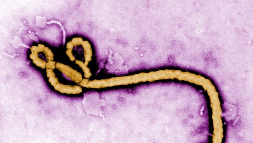Le virus Ebola. ©FrederickMurphy