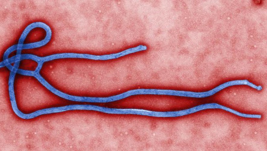 Image du virus Ebola grossi au microscope obtenu le 24 mars 2014 par le Centre de contrôle des maladies d'Atlanta, en Géorgie