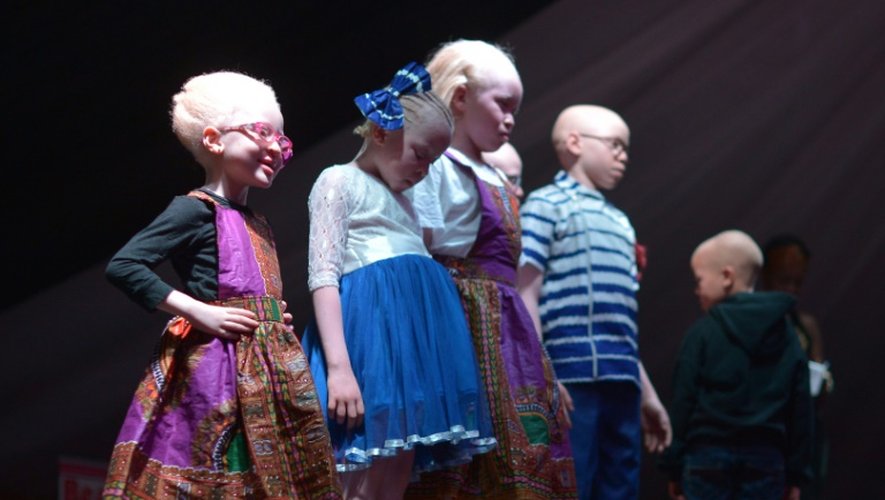 Des enfants albinos participent à l'élection des premiers Miss et Mister Albinisme Kenya, le 21 octobre 2016 à Nairobi