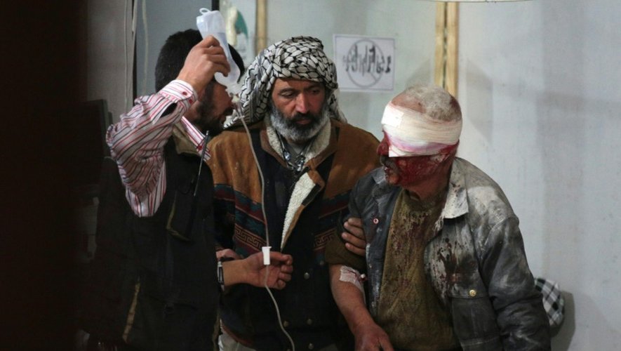 Un Syrien blessé par des frappes aériennes du régime le 18 novembre 2015 à Douma