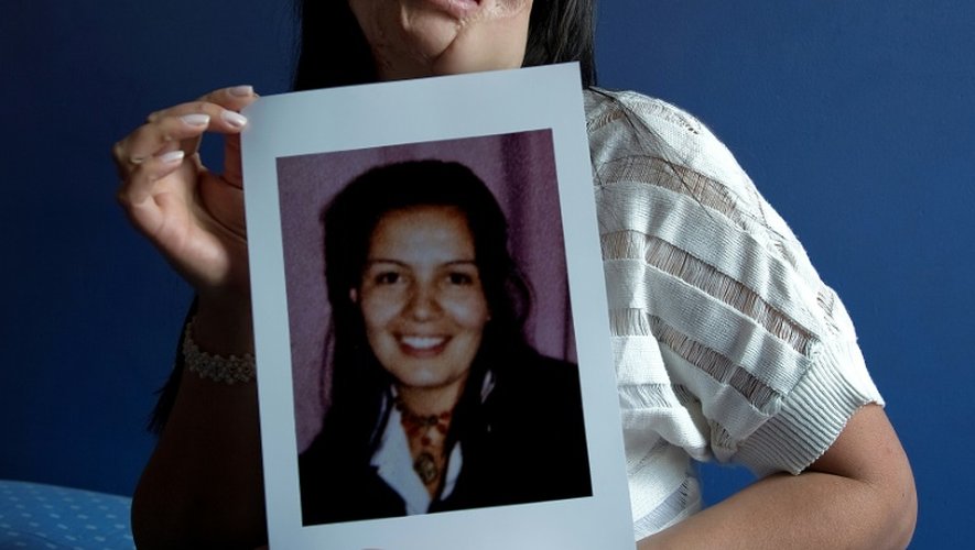 La Colombienne Nubia Espitia, 33 ans, pose chez elle le 5 mars 2012 avec une photo d'elle avant qu'elle soit défigurée à l'acide