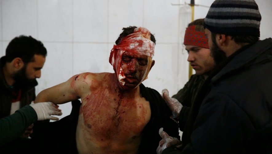 Un homme blessé lors d'un raid des forces gouvernementales syriennes, soigné le 24 décembre 2015 à Hammuriyeh
