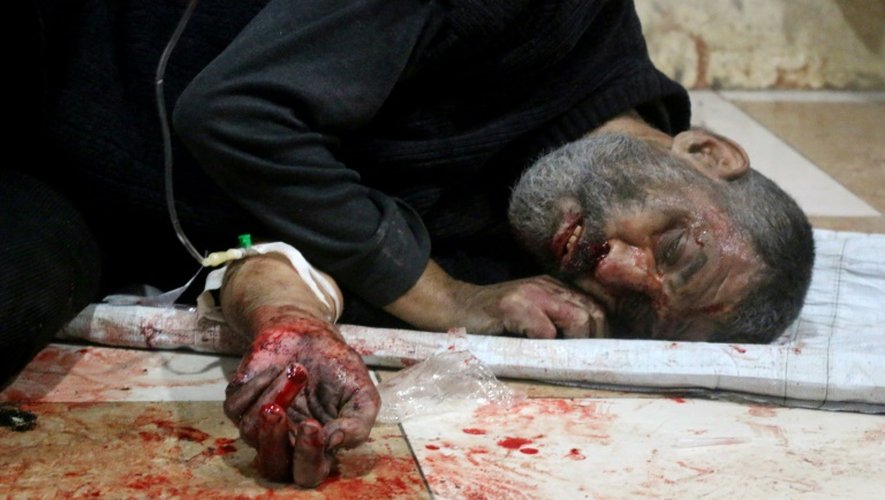 Un syrien blessé git sur le sol dans un hôpital bondé de e l'ouets d'Alep, le 18 novembre 2016