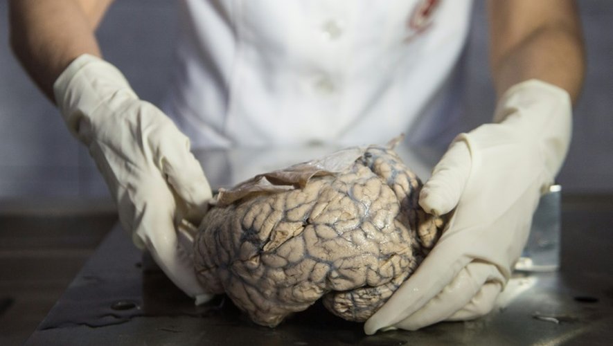 La doctoresse Diana Rivas manipule un cerveau humain extrait d'un bocal de formol au musée de neuropathologie de Lima, le 16 novembre 2016
