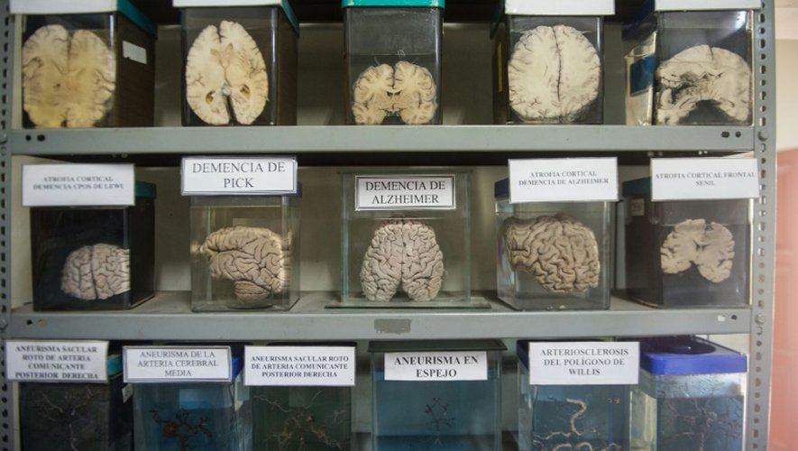 Une collection de cerveaux humains atteints par différentes maladies, au musée de neuropathologie de Lima, le 16 novembre 2016