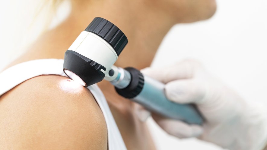 Trois cent dermatologues proposent un dépistage gratuit dans leur cabinet du 14 au 18 mai