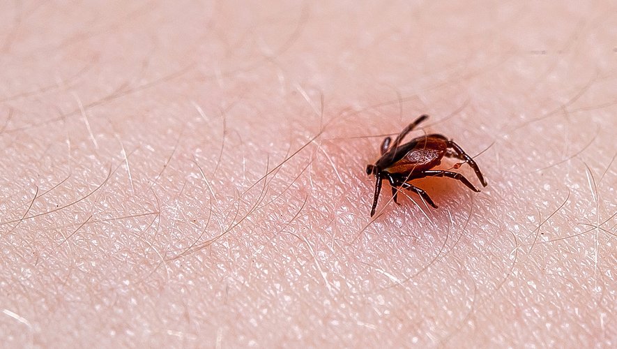 Le nombre de cas de maladie de Lyme est estimé à plus de 54.600 en 2016
