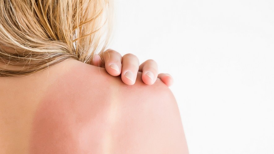 Soleil et cancers : les idées reçues ont la peau dure