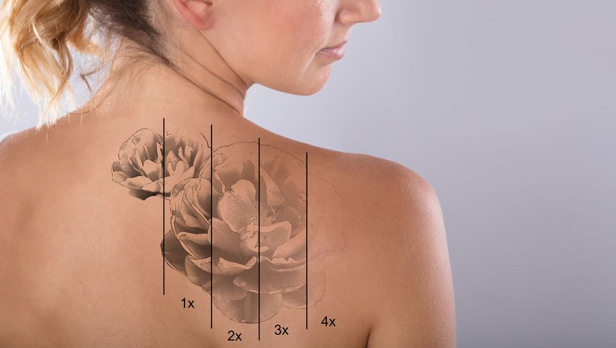 56% des Français déclarent avoir une mauvaise image des tatouages, selon une étude réalisée par Harris Interactive pour les zooms de L'Observatoire Cetelem.