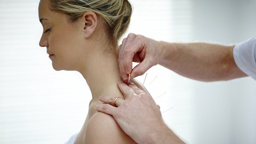 L'acupuncture est la deuxième pratique de médecine douce la plus consultée.
