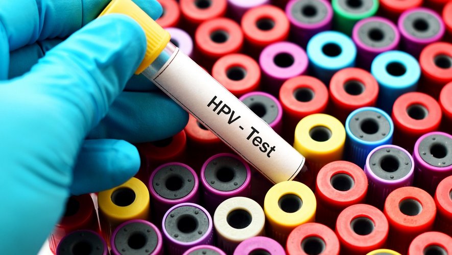 Cancer du col de l’utérus : à quand le remboursement du test HPV ?