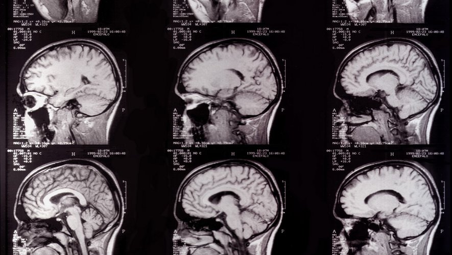 Quel rôle pour les cils dans notre cerveau ?